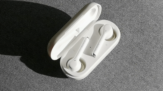 pHallo-HONOR-Communityppseit-paar-Monaten-besitze-ich-die-HONOR-Magic