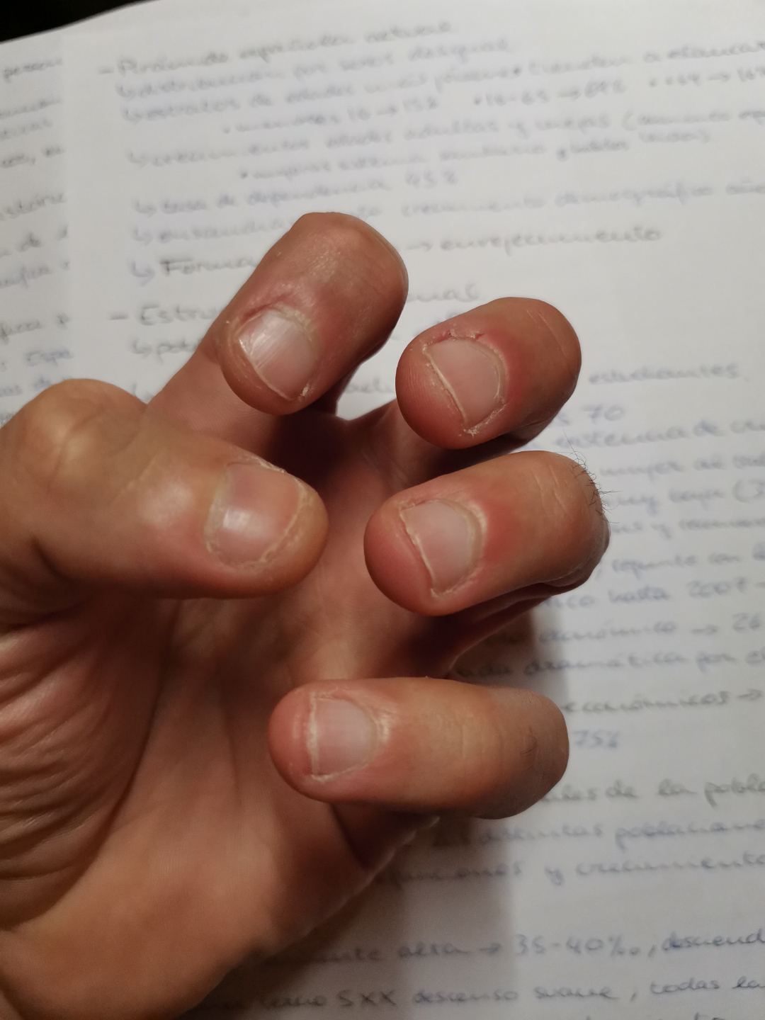 pimg-srchttpsiforum-dechihonorcomesdataimages20212486fcbdf4-8f65-4c92