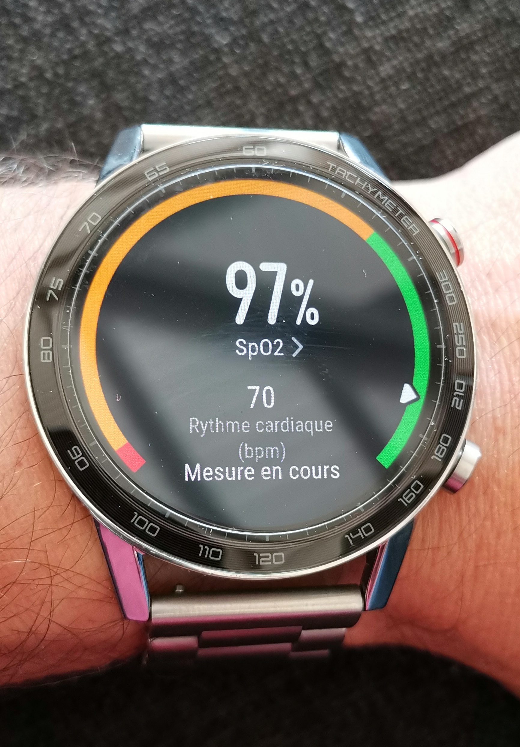 MISE-A-JOUR-HONOR-Magic-Watch-2---v10632