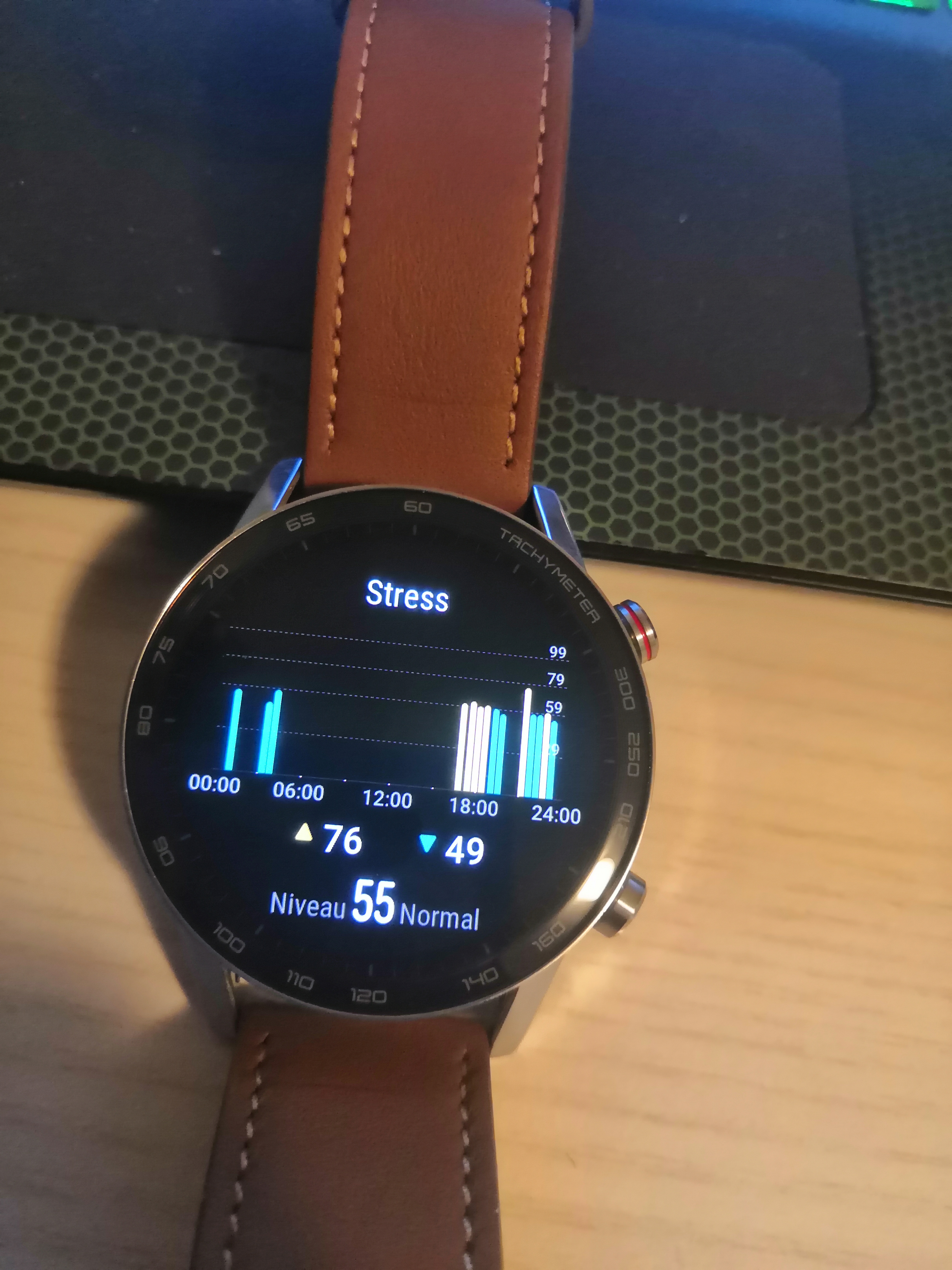 Reviews-Retours-sur-lutilisation-de-HONOR-Magic-Watch-2